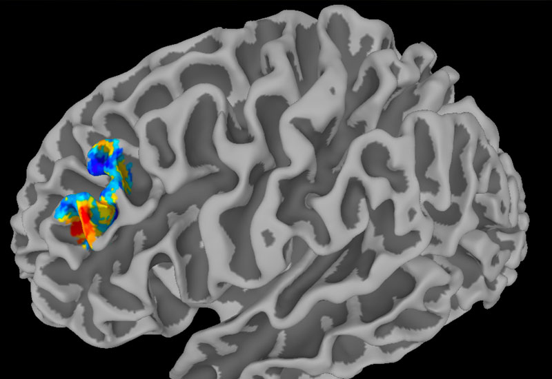 Menninger Clinic | Menninger Offers Groundbreaking Rapid Targeted TMS to Treat Depression
